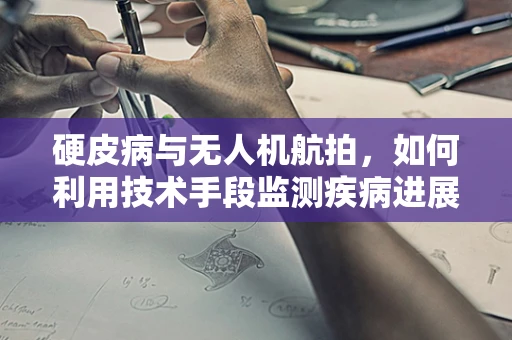 硬皮病与无人机航拍，如何利用技术手段监测疾病进展？